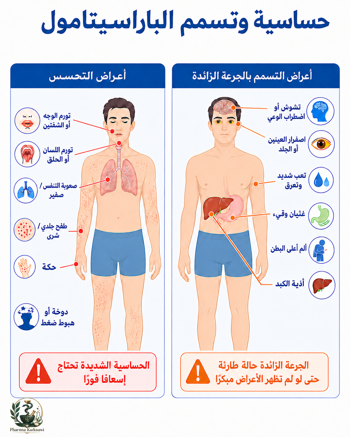 حساسية الباراسيتامول وتسممه: أعراض قد لا تنتظرها وخطر يبدأ بصمت